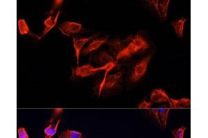 Immunofluorescence analysis of U-2 OS cells using CLUH Polyclonal Antibody at dilution of 1:100 (40x lens). (CLUH antibody)