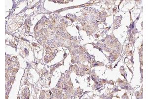Immunohistochemistry (IHC) image for anti-Protein Phosphatase 1, Regulatory (Inhibitor) Subunit 1B (PPP1R1B) (pThr75) antibody (ABIN6255735)