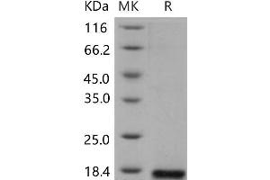 Western Blotting (WB) image for Phospholipase A2, Group IIE (PLA2G2E) protein (His tag) (ABIN7320192) (PLA2G2E Protein (His tag))