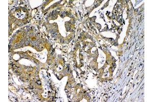 Immunohistochemistry (IHC) image for anti-Complement Factor D (CFD) (AA 26-253) antibody (ABIN5692792)