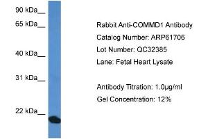 Western Blotting (WB) image for anti-Copper Metabolism (Murr1) Domain Containing 1 (COMMD1) (C-Term) antibody (ABIN2788874) (COMMD1 antibody  (C-Term))