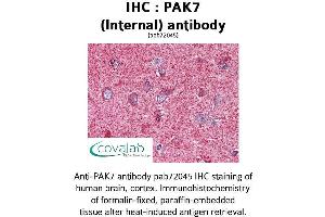 Image no. 1 for anti-P21 Protein (Cdc42/Rac)-Activated Kinase 7 (PAK7) (Internal Region) antibody (ABIN1737840) (PAK7 antibody  (Internal Region))