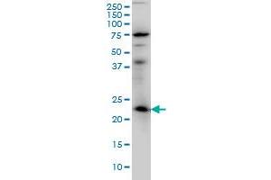 RAB3A monoclonal antibody (M01), clone 4H7 Western Blot analysis of RAB3A expression in IMR-32 . (RAB3A antibody  (AA 122-220))