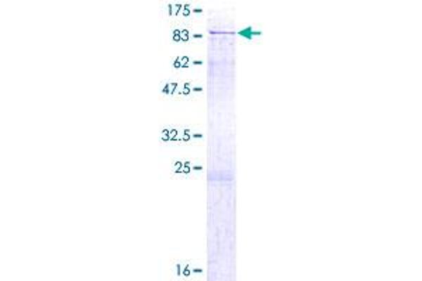Deltex Homolog 1 Protein (AA 1-620) (GST tag)