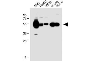 All lanes : Anti-ALDH1A1 Antibody (Center) at 1:1000 dilution Lane 1: A549 whole cell lysate Lane 2: HepG2 whole cell lysate Lane 3: HT-29 whole cell lysate Lane 4: Mouse lung lysate Lane 5: Mouse liver lysate Lysates/proteins at 20 μg per lane.