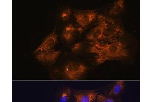 Immunofluorescence analysis of C6 cells using C1 Inactivator Polyclonal Antibody at dilution of 1:100. (SERPING1 antibody)