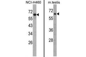 Image no. 1 for anti-Fascin 3 (FSCN3) (N-Term) antibody (ABIN452991) (Fascin 3 antibody  (N-Term))