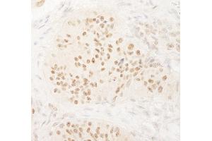 anti-Kinesin Family Member C1 (KIFC1) (AA 625-673) antibody