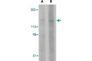 Western blot analysis of BAIAP3 in SK-N-SH cell lysate with BAIAP3 polyclonal antibody  at (A) 1 and (B) 2 ug/mL . (BAIAP3 antibody  (N-Term))