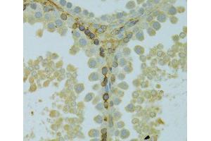 Immunohistochemistry of paraffin-embedded Rat testis using KCNJ1 Polyclonal Antibody at dilution of 1:100 (40x lens).