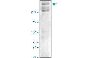 The tissue lysates derived from hypoxic mouse brain were immunoblotted by NF1 polyclonal antibody  at 1 : 1000. (Neurofibromin 1 antibody  (C-Term))