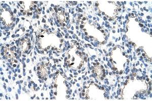 Human Lung (THO Complex 4 antibody  (N-Term))