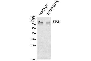 Western Blotting (WB) image for anti-Signal Transducer and Activator of Transcription 1, 91kDa (STAT1) (Internal Region) antibody (ABIN3188009) (STAT1 antibody  (Internal Region))