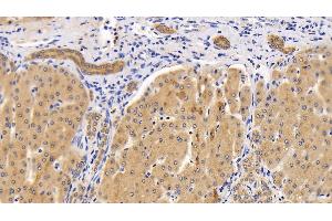 Detection of SQSTM1 in Human Liver Tissue using Polyclonal Antibody to Sequestosome 1 (SQSTM1) (SQSTM1 antibody  (AA 136-400))