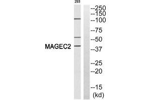 Western Blotting (WB) image for anti-Melanoma Antigen Family C, 2 (MAGEC2) (Internal Region) antibody (ABIN1852688) (MAGEC2 antibody  (Internal Region))