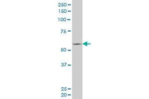 FLI1 monoclonal antibody (M02), clone 2G8. (FLI1 antibody  (AA 1-452))