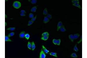 Immunofluorescent analysis of LO2 cells using ABIN7164457 at dilution of 1:100 and Alexa Fluor 488-congugated AffiniPure Goat Anti-Rabbit IgG(H+L) (GPR146 antibody  (AA 301-333))