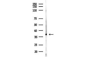 anti-Stimulated By Retinoic Acid 8 (STRA8) (Internal Region) antibody