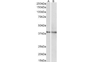 ABIN2563339 (1µg/ml) staining of Rat (A) and Pig (B) Heart lysate (35µg protein in RIPA buffer). (IDH3G antibody  (AA 337-350))