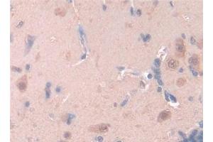 Detection of LEP in Rat Brain Tissue using Polyclonal Antibody to Leptin (LEP) (Leptin antibody  (AA 22-167))