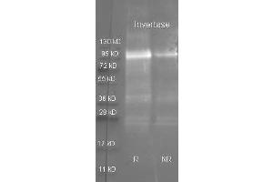 Goat anti Invertase antibody ( was used to detect purified invertase under reducing (R) and non-reducing (NR) conditions. (Sucrase Isomaltase, Regulatory (SI-R) antibody (Biotin))