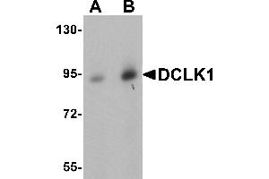 Western Blotting (WB) image for anti-Doublecortin-Like Kinase 1 (DCLK1) (N-Term) antibody (ABIN1031345) (DCLK1 antibody  (N-Term))
