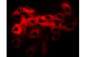 Immunofluorescent analysis of Tropomyosin staining in Hela cells. (Tropomyosin antibody)