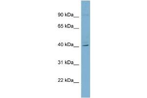 WB Suggested Anti-RFPL3 Antibody Titration: 0. (RFPL3 antibody  (Middle Region))