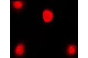 Immunofluorescent analysis of FKBP4 staining in Jurkat cells. (FKBP4 antibody)