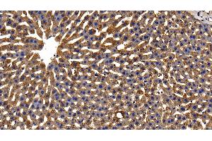 Detection of GPX1 in Rat Liver Tissue using Polyclonal Antibody to Glutathione Peroxidase 1 (GPX1) (Glutathione Peroxidase 1 antibody  (AA 48-201))