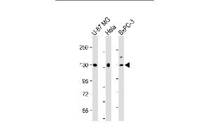 All lanes : Anti-MGEA5 Antibody (N-Term) at 1:2000 dilution Lane 1: U-87 MG whole cell lysate Lane 2: Hela whole cell lysate Lane 3: BxPC-3 whole cell lysate Lysates/proteins at 20 μg per lane.