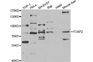 Western blot analysis of extracts of various cell lines, using FOXP2 antibody. (FOXP2 antibody)