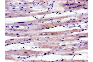 Immunohistochemistry of paraffin-embedded human heart tissue using ABIN7143036 at dilution of 1:100 (ABLIM1 antibody  (AA 174-319))