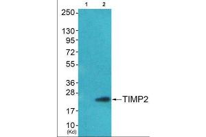 Western Blotting (WB) image for anti-Metalloproteinase Inhibitor 2 (TIMP2) (Internal Region) antibody (ABIN1848808) (TIMP2 antibody  (Internal Region))