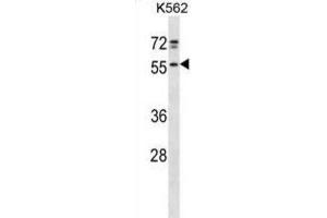 Western Blotting (WB) image for anti-NFS1, Cysteine Desulfurase (NFS1) antibody (ABIN2998727) (NFS1 antibody)