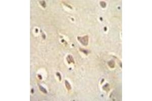 Immunohistochemistry analysis in formalin fixed and paraffin embedded human brain tissue reacted with MCHR1 / GPR24 Antibody (C-term) followed which was peroxidase conjugated to the secondary antibody and followed by DAB staining. (MCHR1 antibody  (C-Term))