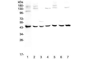 Western blot testing of 1) human MCF7, 2) rat brain, 3) rat kidney, 4) rat testis, 5) mouse brain, 6) mouse kidney and 7) mouse testis lysate with WWOX antibody at 0. (WWOX antibody)