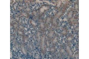 Detection of FSH in Mouse Kidney Tissue using Polyclonal Antibody to Follicle Stimulating Hormone (FSH) (FSH antibody  (AA 25-120))