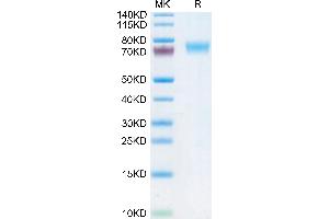 Fc epsilon RI/FCER1A Protein (AA 26-205) (Fc Tag)