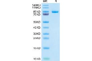 Human CD228 on Tris-Bis PAGE under reduced condition. (MFI2 Protein (AA 20-709) (His tag))