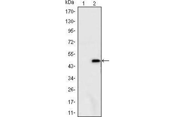 Ataxin 1 antibody