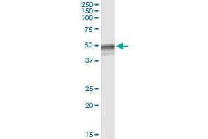 Immunoprecipitation of HYAL3 transfected lysate using anti-HYAL3 MaxPab rabbit polyclonal antibody and Protein A Magnetic Bead , and immunoblotted with HYAL3 purified MaxPab mouse polyclonal antibody (B01P) . (HYAL3 antibody  (AA 1-417))