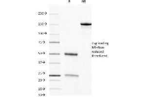 SDS-PAGE Analysis Purified CD8 Mouse Monoclonal Antibody (C8/468). (CD8 alpha antibody)