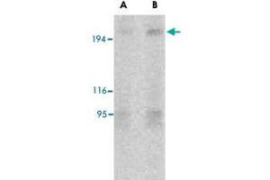 Western blot analysis of TSC2 in L1210 cell lysate with TSC2 polyclonal antibody  at (A) 2 and (B) 4 ug/mL . (Tuberin antibody  (N-Term))