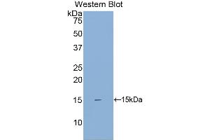 Detection of Recombinant SIGIRR, Human using Polyclonal Antibody to Single Ig IL1 Related Receptor (SIGIRR) (SIGIRR antibody  (AA 1-118))