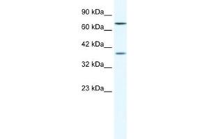 Human HepG2; WB Suggested Anti-ZNF660 Antibody Titration: 1.