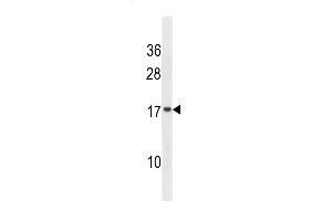 Western blot analysis in NCI-H292 cell line lysates (35ug/lane). (VAMP4 antibody  (AA 61-90))