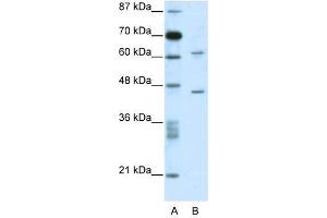 C1ORF25 antibody used at 0. (TRMT1L antibody  (N-Term))