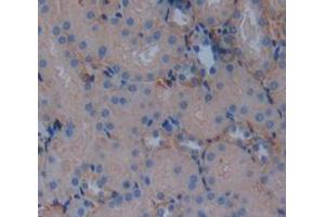 Immunohistochemistry (Paraffin-embedded Sections) (IHC (p)) image for anti-Platelet/endothelial Cell Adhesion Molecule (PECAM1) (AA 78-214) antibody (ABIN2920536)
