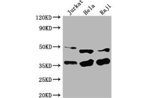 Western Blotting (WB) image for anti-Nuclear Factor of kappa Light Polypeptide Gene Enhancer in B-Cells Inhibitor, alpha (NFKBIA) (AA 27-317) antibody (ABIN7161520)